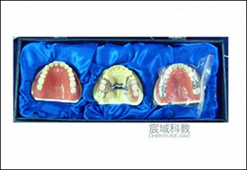 CY-KQ044 口腔修复套装模型