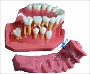 CY-KQ069 牙列发育模型C