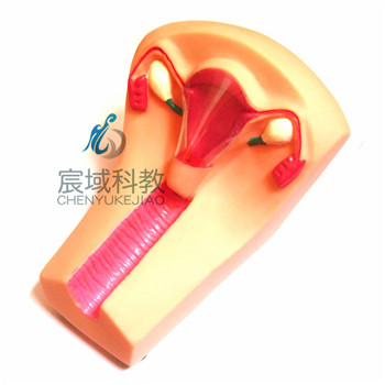 CY-F5N 女性宫内避孕器及训练模型