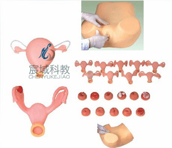 CY-F30S 高级妇科检查训练模型