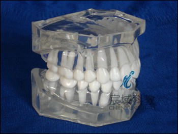 CY-KQ021 标准水晶牙列模型(无颌架)