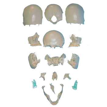 CY-A11117/2 部分颅骨散骨模型
