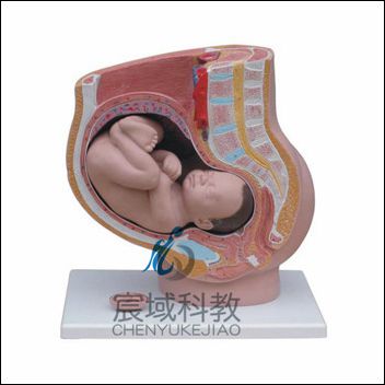 女性妊娠矢状解剖模型（附胎儿）(4件)