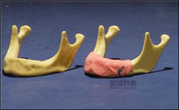 CY-KQ047 仿真下颌骨种植练习模型