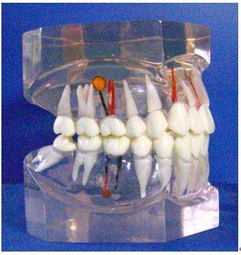 CY-KQ011 综合病理水晶牙列模型(32颗牙)