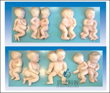 CY-LY2083 胎儿畸形模型