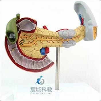 胰、脾、十二指肠病变模型