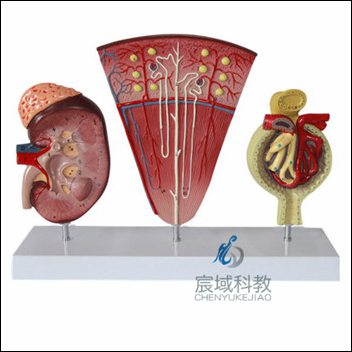 肾与肾单位 肾小球模型（缩小版）